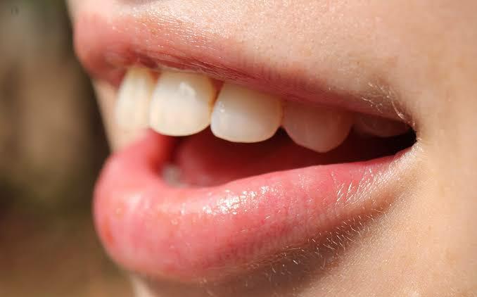 Kenapa Bumil Sering Sakit Gigi? Ini Cara Mengatasinya