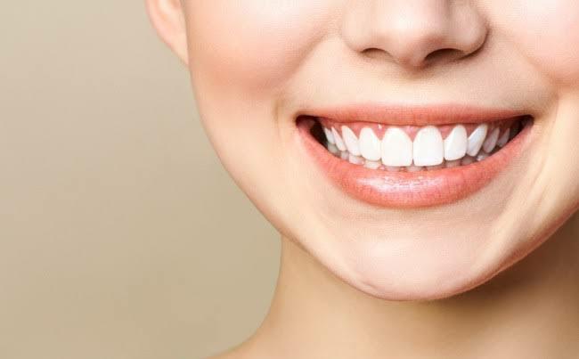 Delapan Jenis Perawatan Gigi yang Ditanggung BPJS Kesehatan 2024