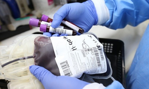 RSUD Pesawaran Kaji Ulang Pembayaran Kelebihan Kantong Darah