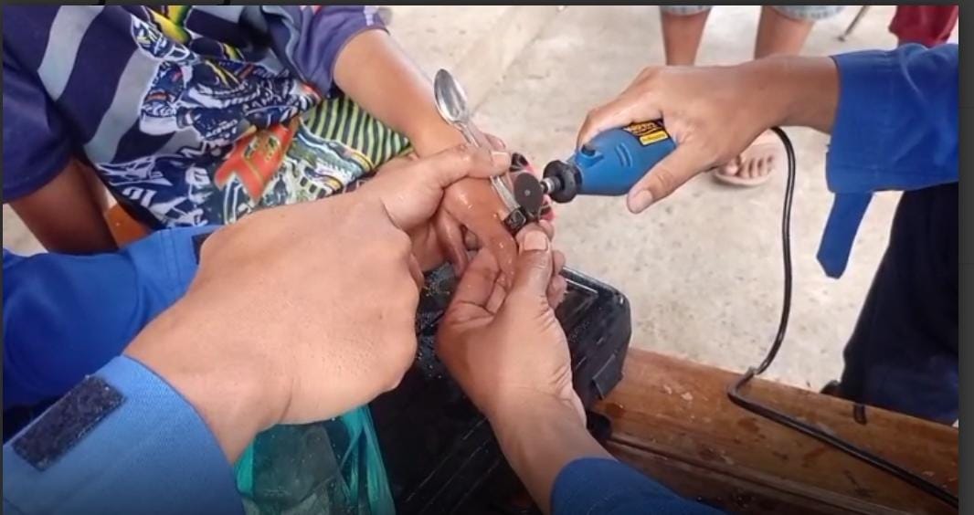 Aksi Sigap Damkarmat Metro Selamatkan Jari Balita Dari Jerat Baut Baja