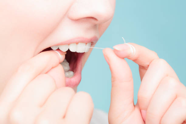 Begini Cara Mudah Hilangkan Karang Gigi Hitam Secara Alami