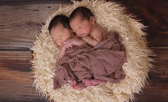 Mengenal Bayi Kembar Siam Parapagus, Apakah Bisa Dilakukan Operasi Pemisahan?
