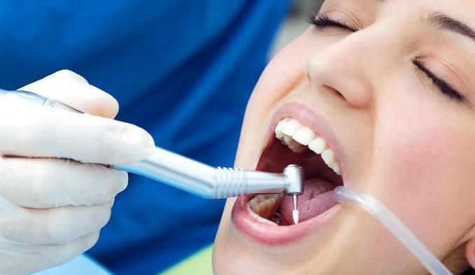 Jangan Sampai Jadi Sarang Bakteri, 5 Perawatan Mudah Setelah Tambal Gigi