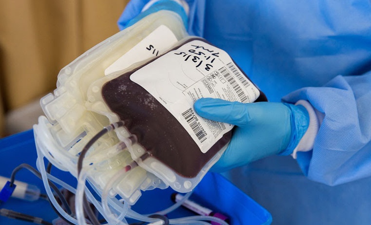 Soal Pembayaran Kelebihan Kantong Darah, Ini Kata Kepala Diskes Pesawaran