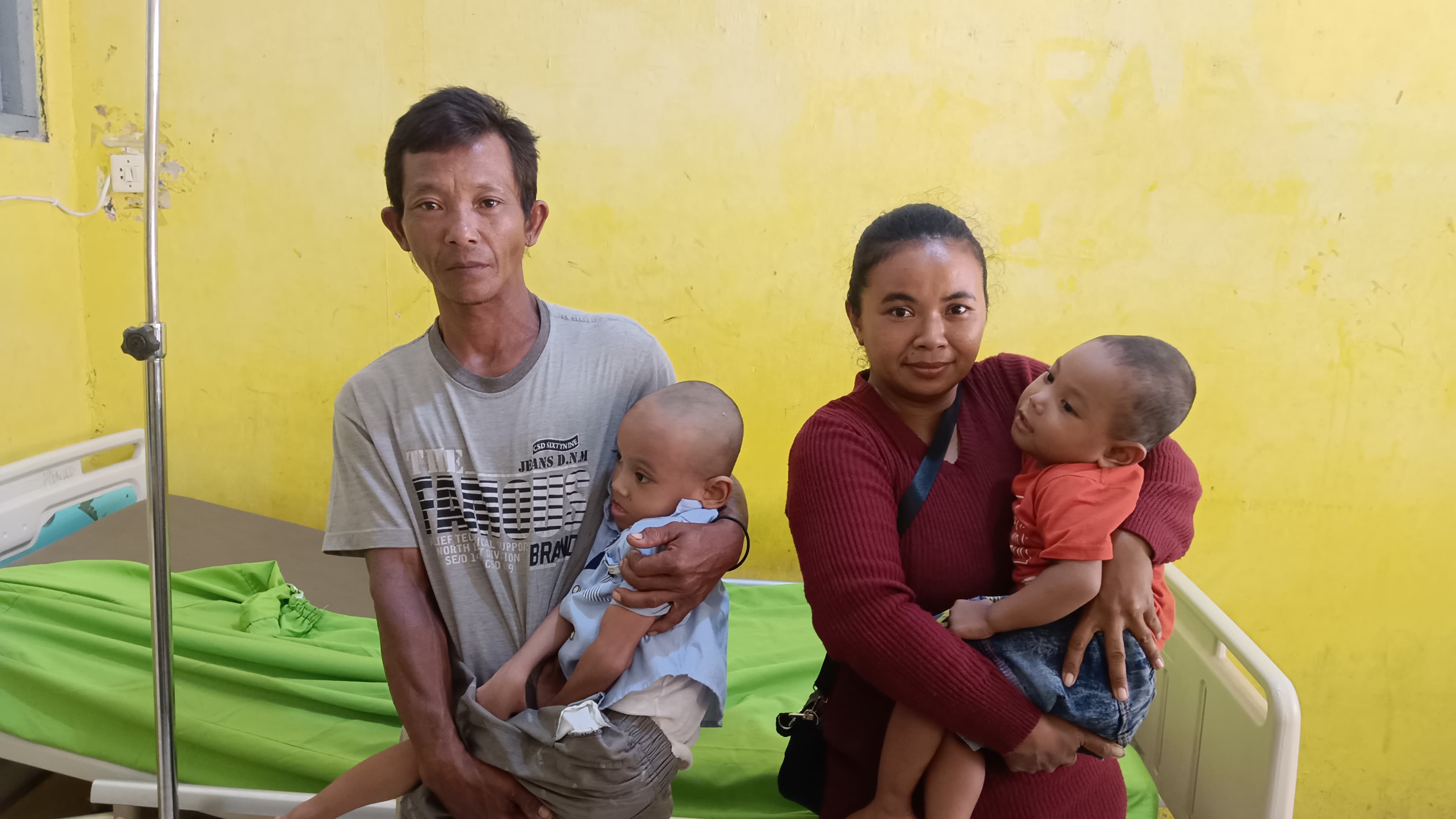 Dua Anak di Lampura Alami Gizi Buruk, Keluarga Buruh Serabutan Harap Uluran Tangan