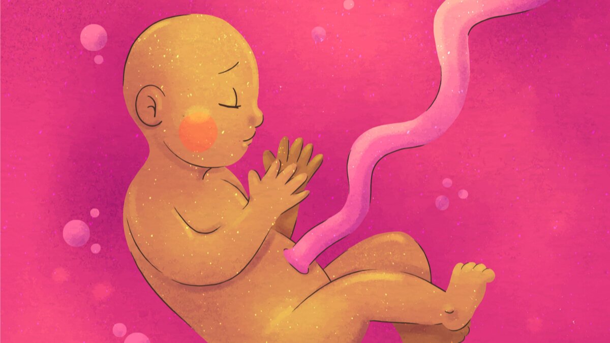 Heboh Kabar Bayi 'Hamil', Ternyata Diduga Alami Fetus In Fetu, Begini Penjelasan Ilmiahnya