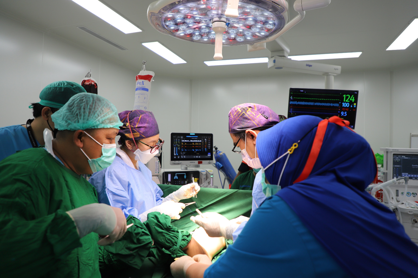 Operasi Pemisahan Kembar Siam Pertama Berhasil, Memakan Waktu Hingga 5 Jam di Meja Operasi