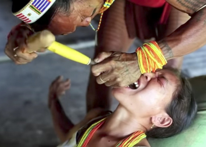 Tradisi Meruncingkan Gigi Suku Mentawai Agar Terlihat Cantik
