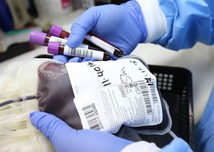 RSUD Pesawaran Kaji Ulang Pembayaran Kelebihan Kantong Darah