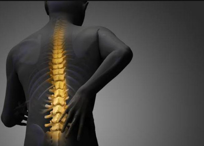 4 Cara Mendeteksi Osteoporosis di Usia Muda, Kenali Gejalanya