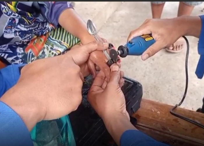 Aksi Sigap Damkarmat Metro Selamatkan Jari Balita Dari Jerat Baut Baja