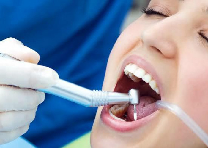 Jangan Sampai Jadi Sarang Bakteri, 5 Perawatan Mudah Setelah Tambal Gigi