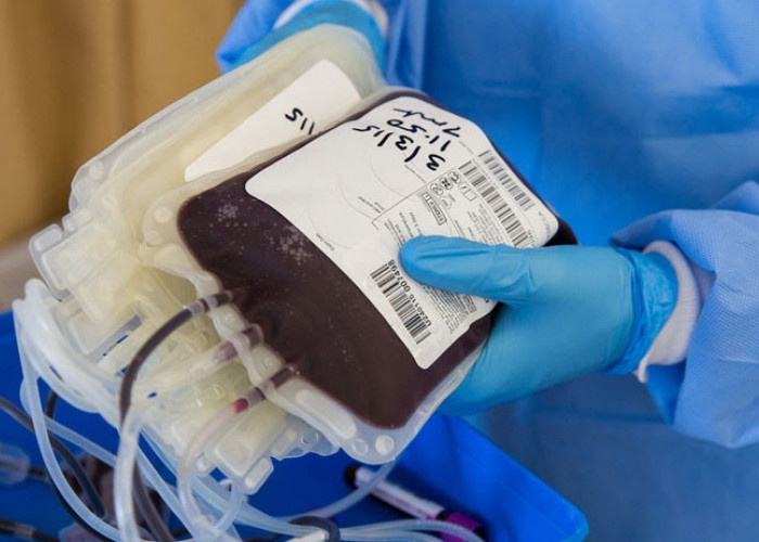 Soal Pembayaran Kelebihan Kantong Darah, Ini Kata Kepala Diskes Pesawaran