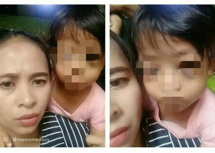 Curhatan Seorang Ibu Usai Mata Sang Anak Bengkak Akibat Sering Main Handphone, Warganet: Curiga Emaknya...