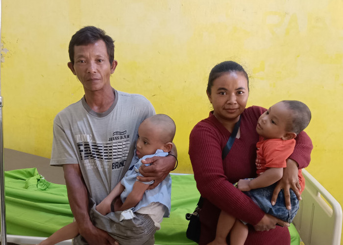 Dua Anak di Lampura Alami Gizi Buruk, Keluarga Buruh Serabutan Harap Uluran Tangan