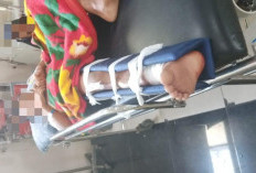 Hari Pertama Masuk Sekolah Berujung Pilu, Ibu dan Anak Alami Patah Tulang Usai Tabrakan di Jalinsum Kalianda