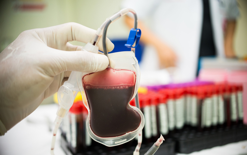 HAB Ke-59, Kejari Pringsewu Gelar Donor Darah