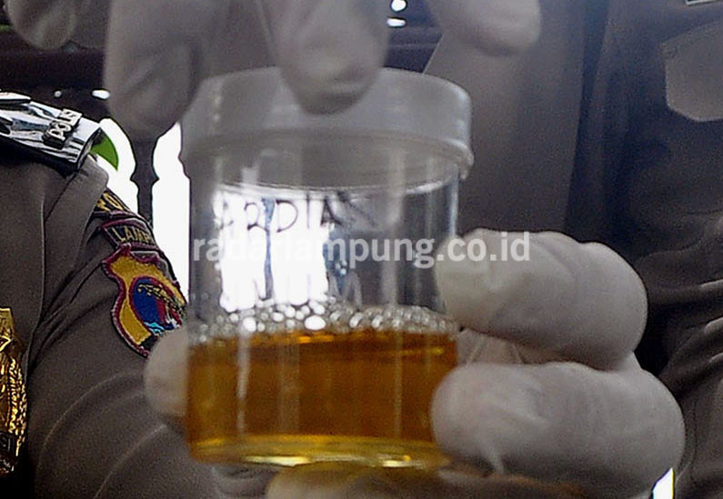 Awas, ASN Lamtim Akan Tes Urine Massal!